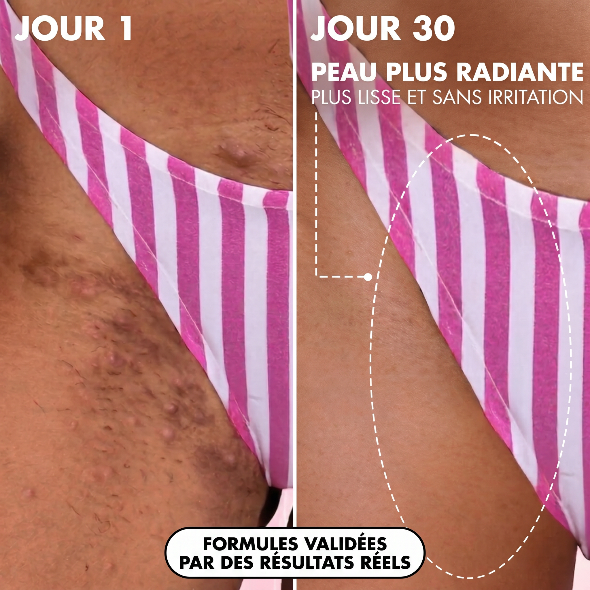Goddess Glow™ - Huile régénérante après épilation